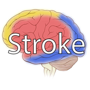 Stroke Medicine Notes: Classification and Types of Stroke with MCQs ...